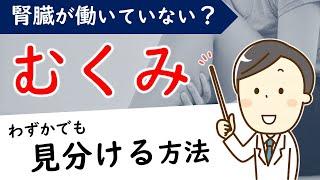 【1日1分】腎不全のサイン「むくみ」早く見つける方法は？【腎臓内科医が解説】