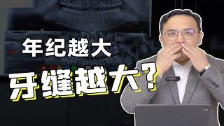 牙齿矫正 | 年龄越大牙缝越大，有没有解决方法？