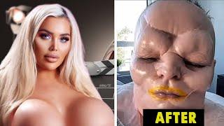 25 Celebrity Plastic Surgery Disasters