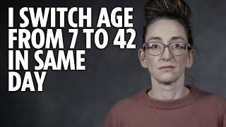 My medical condition means I switch age from 7 to 42 in the same day  | Life Stories