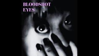 MOGY - Bloodshot Eyes