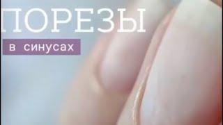 Порезы в синусах / работа фрезой пламя / аппаратный маникюр/ новичок