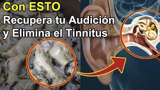 Recupera tu Audición y Elimina el Zumbido de Oídos (Tinnitus) con ESTO