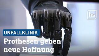 Hightech-Prothesen aus Frankfurt | hessenschau