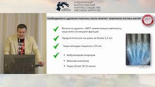 Цыбуль Е.С.: способ изоляции накостных пластин при остеосинтезе переломов пястных костей.