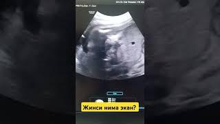 Жинси нима экан?