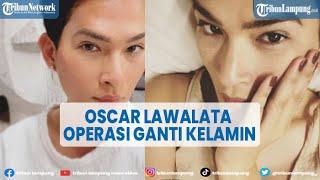 Oscar Lawalata Operasi Ganti Kelamin, Mantap Jadi Perempuan