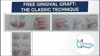 FREE GINGIVAL GRAFT: THE CLASSIC TECHNIQUE|PERIODONTAL PLASTIC AND ESTHETIC SURGERY|DR. ANKITA