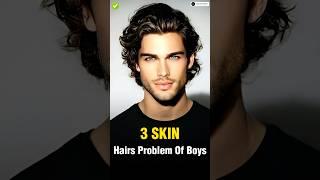 4 Skin & Hair Problems Every Man Faces  || #shorts #viral