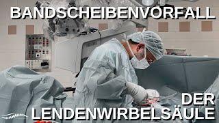 Bandscheibenvorfall der Lendenwirbelsäule#rückenschmerz#wirbelsäule#bandscheibenvorfall#operation