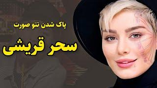 بیوگرافی سحر قریشی | ماجرای تتو های عجیب صورت و بدن سحر قریشی و علت پاک شدن اونها