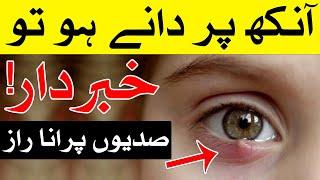 Ankh Par Dana Ho To Khabardar | Eye | Ankhon Par Dane Ka ilaj | Mehrban Ali | Eyes