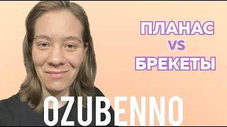 БЕЗ БРЕКЕТОВ: Планас или брекеты? Аппарат Планас