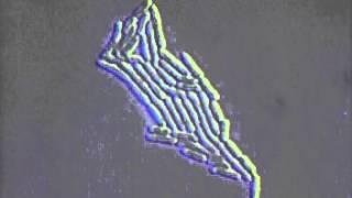 Bacterial growth under the microscope, Rate My Science