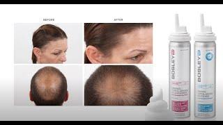 NEW!  Womens & Mens Hair Regrowth Treatment in an EASY TO USE FOAM Application