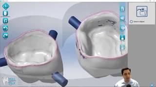 MillBox 2019 - Dental Crown and Bridge Workflow SEE DESCRIPTION**