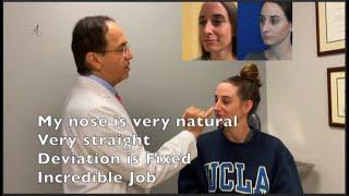 Incredible Nose job| dr. ali Sajjadian| before & after