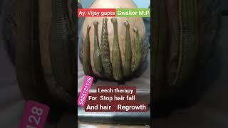 Leech therapy for hair problems