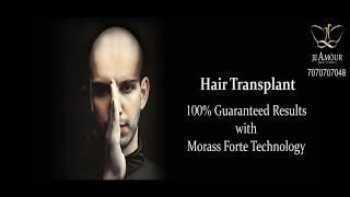 Best Hair Transplant Technology in India | Je Amöur