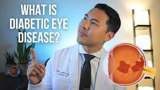 What is diabetic eye disease? Explained by an MD