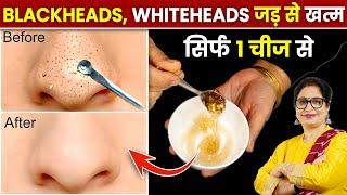 सिर्फ 15 मिनट में Blackheads, Whiteheads, Open Pores, Unwanted Facial Hair को जड़ से हटाए | Face Mask