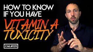 How to Know If You Have Vitamin A Toxicity | Chris Masterjohn Lite #125