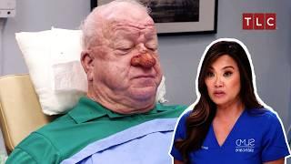 A Patient's 20-Year Battle with Nose! | Dr Pimple Popper | TLC