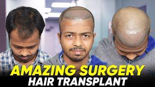 Hair Transplant in Kota | Best Results & Cost of Hair Transplant in Kota