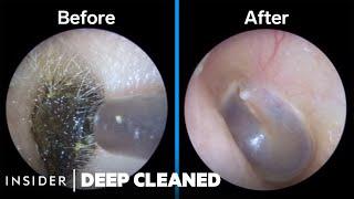 How Earwax Is Professionally Deep Cleaned | Deep Cleaned
