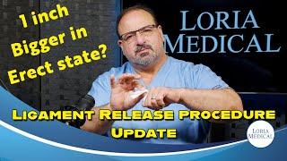 Ligament Release procedure Update. #2024