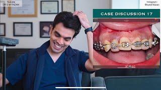 Ortho/braces treatment Disaster - Case 17