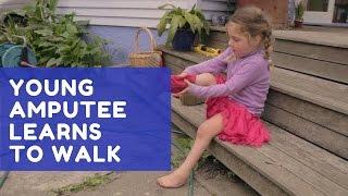 Young amputee learns to walk