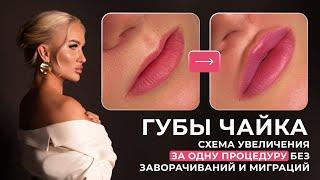 Губы чайка | Схема увеличения за одну процедуру без заворачиваний и миграций