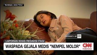 Waspada Gejala Medis "Nempel Molor"