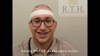 ДО и ПОСЛЕ пересадки волос в клинике Real Trans Hair