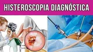 Como é feita a histeroscopia diagnóstica?