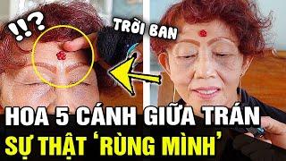 Người phụ nữ sở hữu "BÔNG HOA 5 CÁNH" giữa trán và sự thật ĐÁNG SỢ khiến ai nấy KHÓ TIN | TB Trends