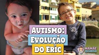 Autismo do Eric ANTES E DEPOIS: Evolução do Nosso FILHO Autista