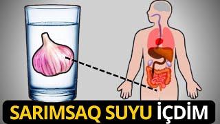 7 Gün Sarımsaq Suyu İçdim - Görün Başıma Nələr Gəldi...