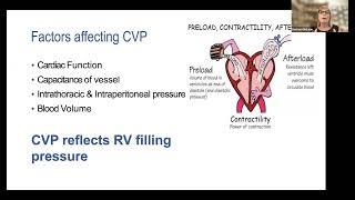 CVP and ECG