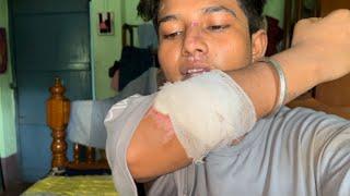 Mera accident Kaise hua hai  ??  //Vlog Video// Adi Lifestyle// #adi #accident