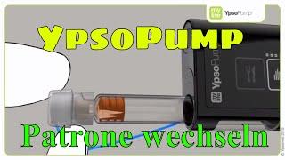 YpsoPump Patrone wechseln Insulinpumpe mylife Diabetescare 08