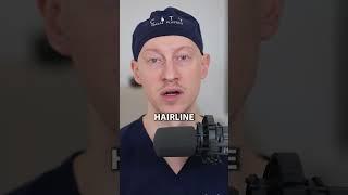 Extreme Facelift Result | Plastic Surgeon Reacts