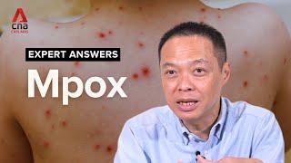 Mpox: How dangerous is the new variant? | Expert Answers | CNA Explains