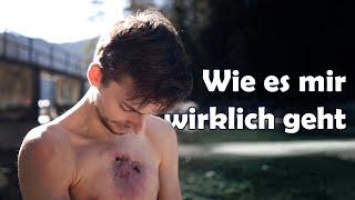 Ich bin schweißgebadet aufgewacht | Gesundheitsupdate