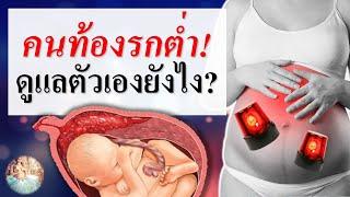 มดลูกเกาะต่ำ : คนท้องรกเกาะต่ำ ดูแลตังเองอย่างไร? | การดูแลคนท้อง | คนท้อง Everything