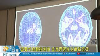 重覆式經顱磁刺激 重度憂鬱症治療新選擇20220914