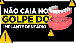 NÃO SEJA ENGANADO na hora de fazer o seu IMPLANTE DENTÁRIO