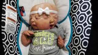 Changing CONJOINED Twin Girls - Twins Share One Body Two Faces