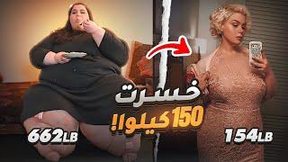 أقوى تحويل تنزيل دهون فالعالم - خسرت 150 كيلو من وزنها !!